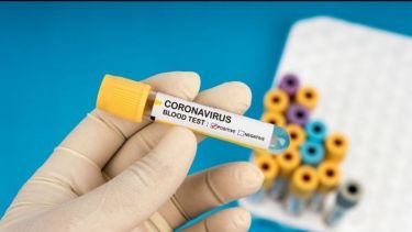 Blood test test tube